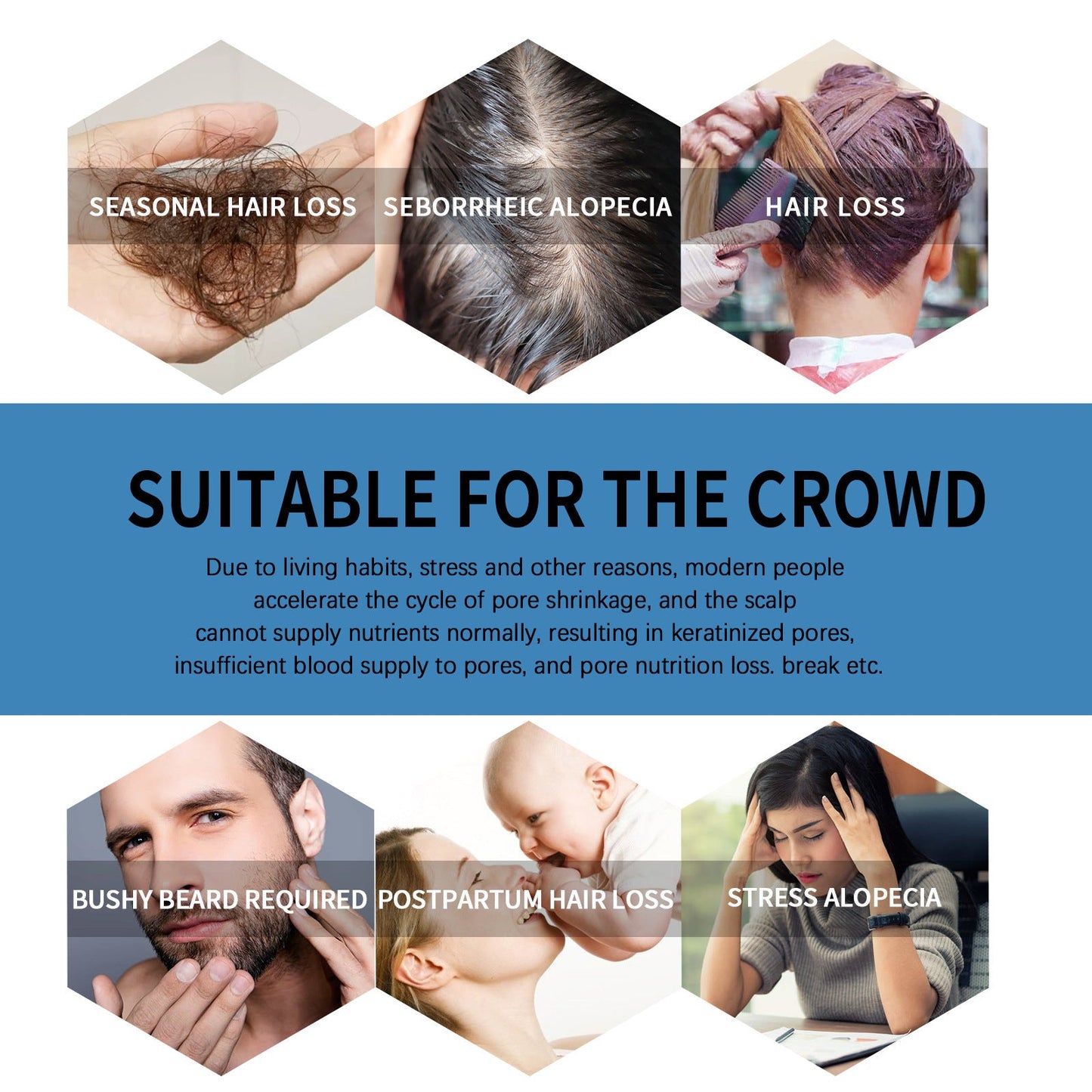 🔥Limited-time 50% off🌿EAST MOON Minoxi Roll-On Hair Treatment