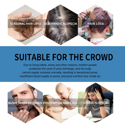 🔥Limited-time 50% off🌿EAST MOON Minoxi Roll-On Hair Treatment