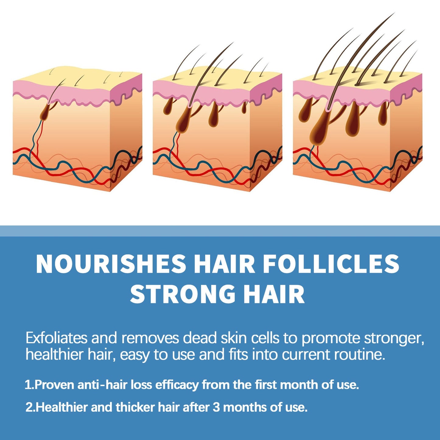 🔥Limited-time 50% off🌿EAST MOON Minoxi Roll-On Hair Treatment