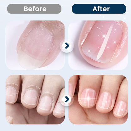 🔥2026 New Arrivals: 50% Off for a Limited Time!🔥Nourishing Nail Repair Spray