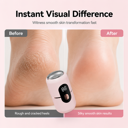 📢📢50% OFF !! ⏰Electric Foot Grinder with 6 Speeds and 5 Replacement Heads for Dead Skin Removal